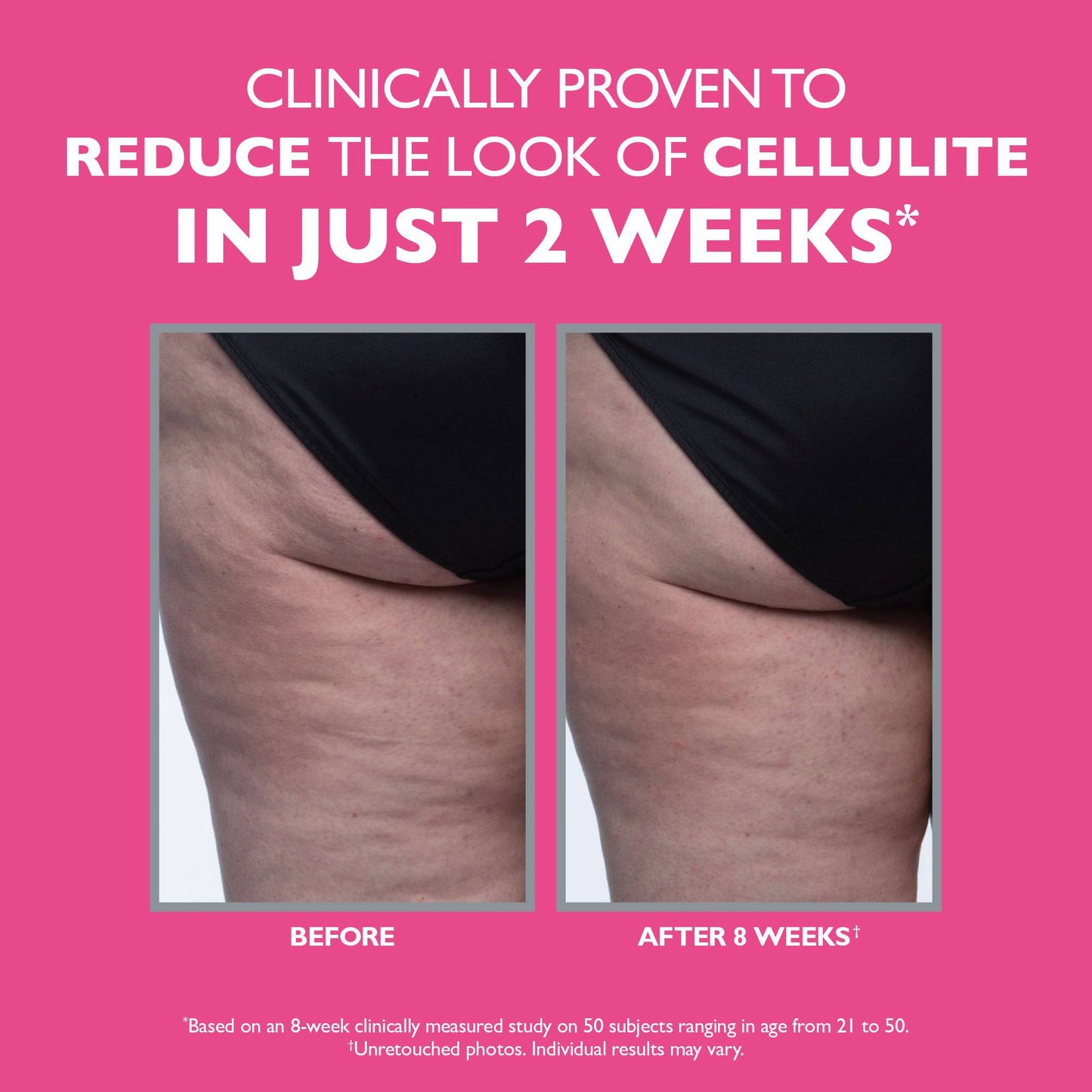 FIRMx Tight & Toned Cellulite Treatment